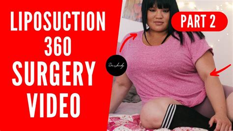 lipo videos